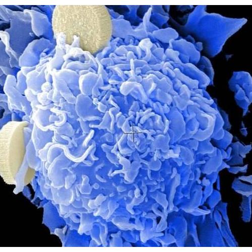  Blocking a 'jamming signal' can unleash immune system to fight tumors 